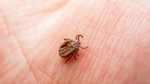 Lyme hastaligi nedir 