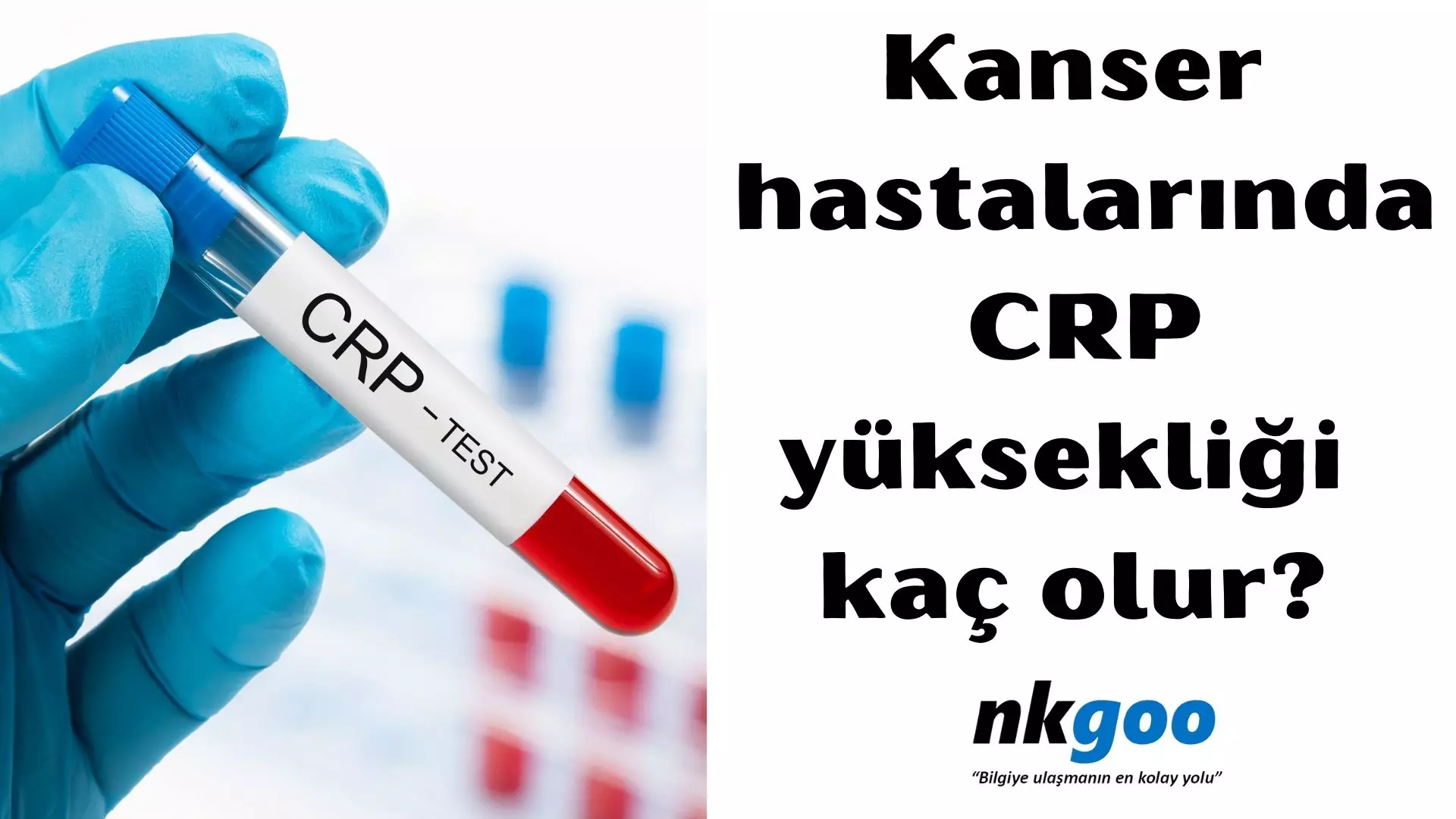 Kanser hastalarında CRP yüksekliği kaç olur?