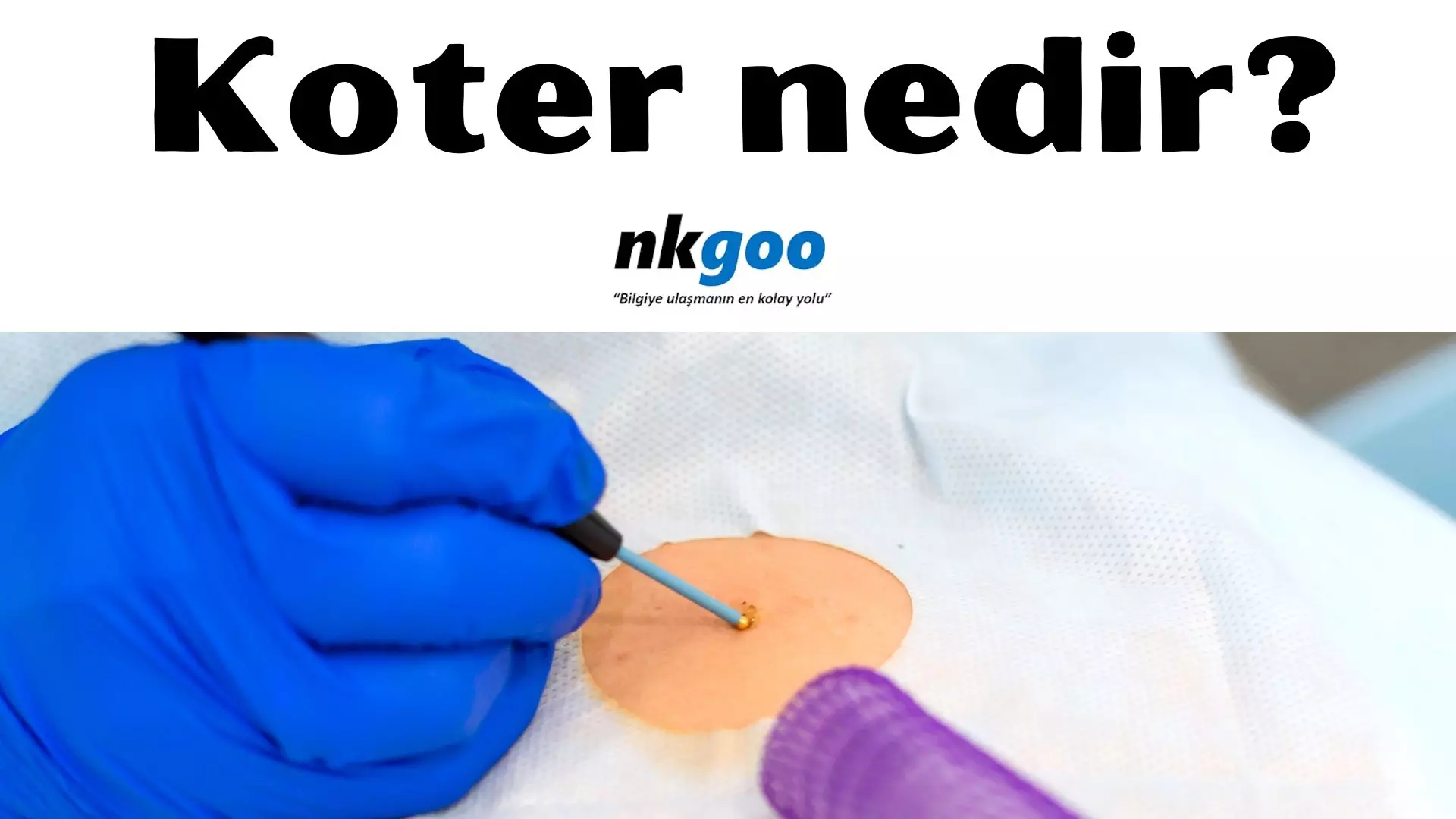 Koter nedir? Koter plağı nedir? Özellikleri