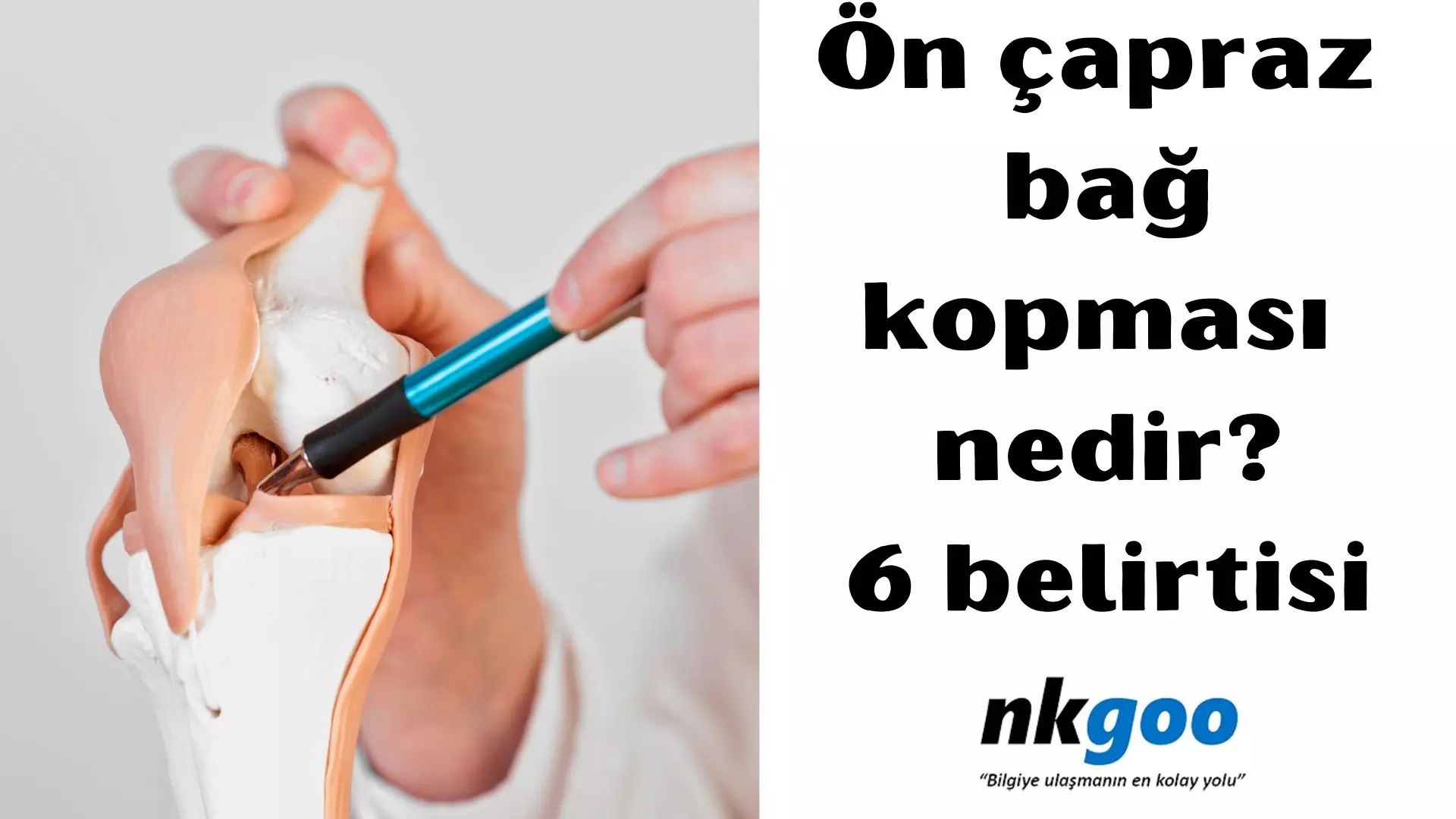 Ön çapraz bağ kopması nedir? 6 belirtisi, tedavisi