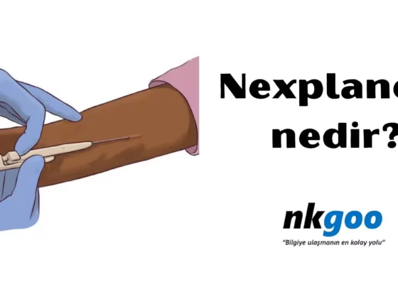 Nexplanon nedir