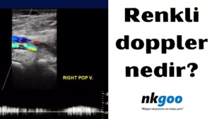 renkli doppler 