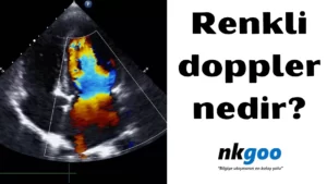 renkli doppler 