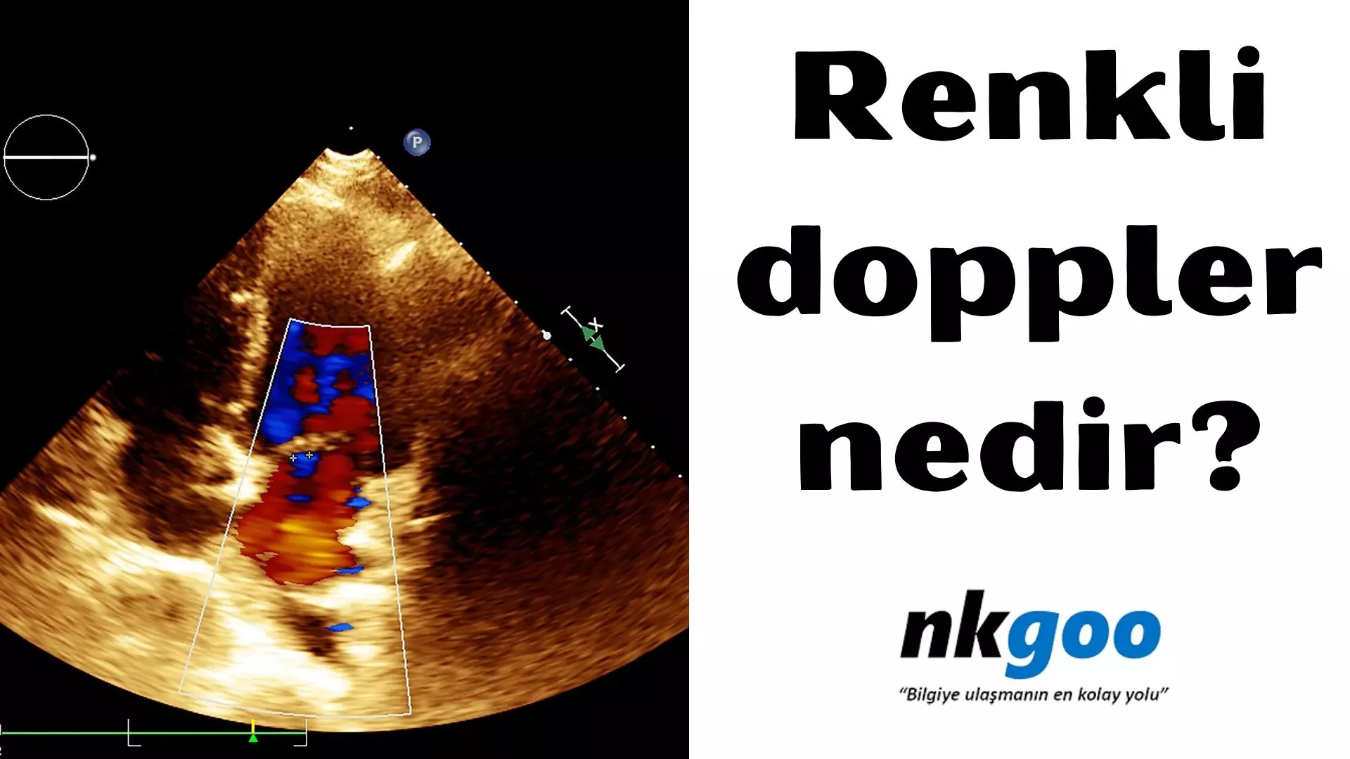 Renkli doppler nedir? Ne işe yarar?