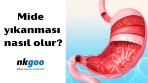 mide yıkanması nasıl olur 